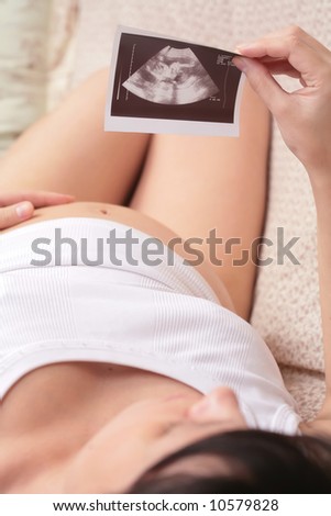 Mother watching ultrasound of her unborn baby