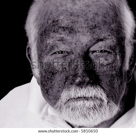 Close up image of man with skin damage from the Sun