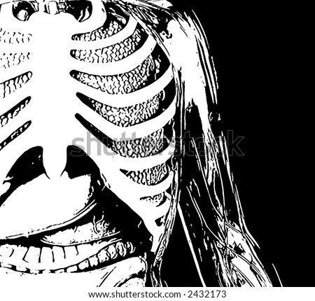 Illustration of a human rib cage