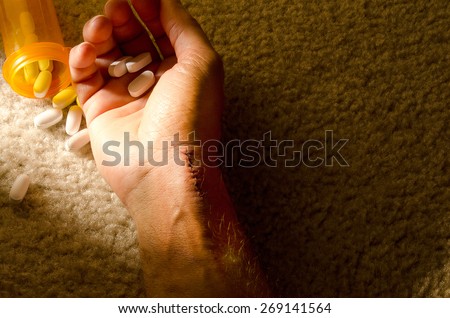 Dead man\'s hand with stitches where he slit his wrist and pills in his hand showing a repeated attempt at suicide which he finally succeeded at.