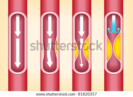 Vein Vector