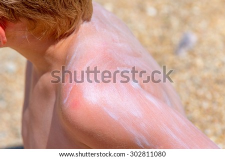 sunscreen plastered on the back of a little boy on a sea beach. Beach Family composition
