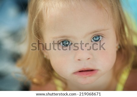 Emotions of a little girl with Down syndrome
