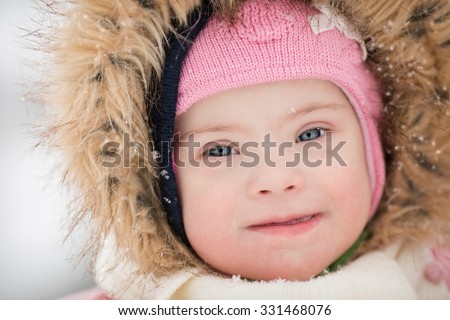 Winter portrait of a girl with Down syndrome