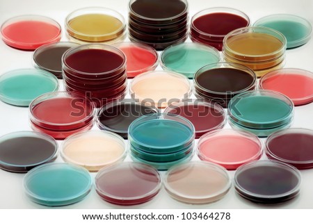 Petri plates containing different culture media in a refrigerator/petri dishes with culture medium