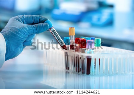 doctor hand taking a blood sample tube from a rack with machines of analysis in the lab background / Technician holding blood tube test in the research laboratory