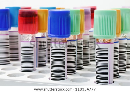 Tubes labeled with bar codes with blood samples inside