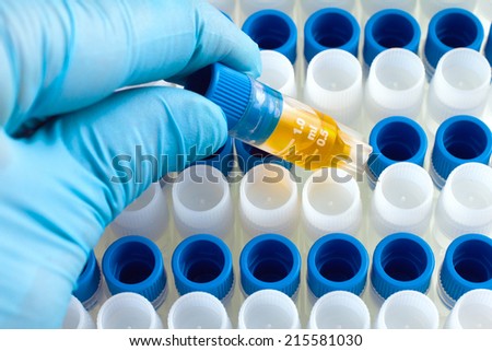 scientist hand with a micro tube rack with biological samples for DNA analysis