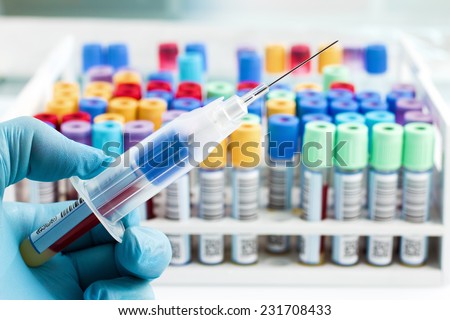 hand of a lab technician holding a tube adapter with needle and background a rack of tubes with blood samples / hand of a lab technician who just collect a blood sample from a patient