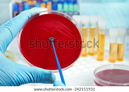 hand of a lab researcher prepared media dish and samples in tubes in the background of a microbiology laboratory