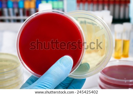 hand of a lab researcher holding prepared media dish and samples in tubes in the background of a microbiology laboratory lab technician holding two petri dish hand of a lab researcher holding prepared media dish and samples in tubes in the background of a microbiology laboratory lab technician holding two petri dish