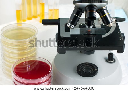 laboratory workbench with a microscope, several petri plates and tubes with urine samples / sample test in laboratory microscope