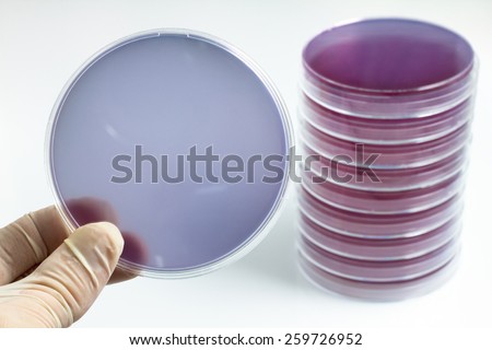 hand of microbiologist holding petri dish in the background white / scientist holding a petri dish