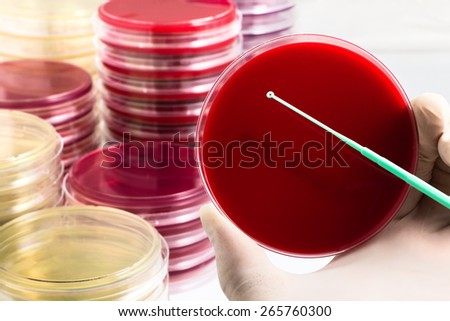 hand of microbiologist holding petri dish in the background white / doctor holding a petri dish in workbench of laboratory