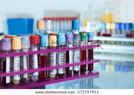 rack with colored tubes in the laboratory workbench / tubes with blood samples in a rack