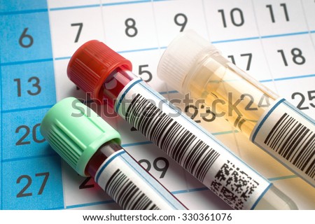 Laboratory work tools of health analysis and in the background a request calendar of citations / tubes of blood and urine samples for analysis with report and calendar citations