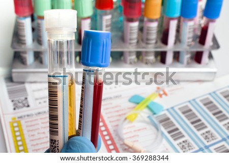 man holding tubes with samples labeled and report for analysis / top view of a work table of lab with blood tubes for analysis and computer
