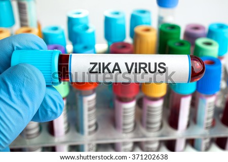 hand holding a tube labeled with the words zika virus and in the background a rack with other tests / Blood tests with text zika virus