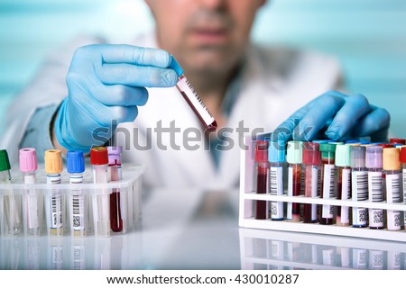 doctor holds a blood sample tube in his hand testing in the laboratory / hands of a technician holding blood tube sample in the lab