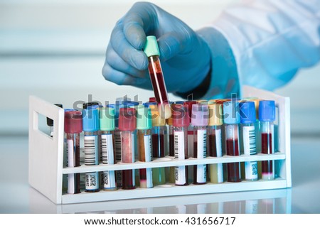 hand of technician holding tube of tray with collection blood samples in the laboratory / hand holding tube of rack with blood test tubes in clinical lab