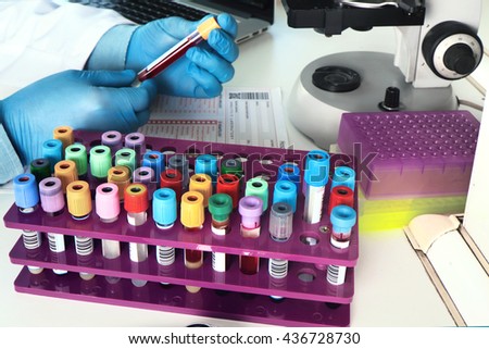 hands of a lab technician with a tube of blood sample and a rack with other samples / hand of a lab technician holding blood tube sample for study