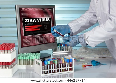 Scientist in laboratory with a tube of blood tested and on display appears infection of Zika virus / hands with blood sample tube with result of diagnosis of zika virus in the screen