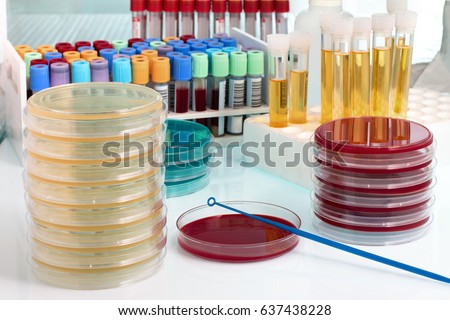 Working table in the analysis lab / workbench with Biological samples on the microbiology laboratory