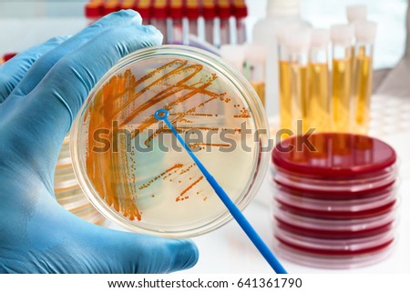 Colonies of bacteria Streptococcus agalactiae in culture medium plate / hand holding plate with bacterial colonies of Streptococcus agalactiae