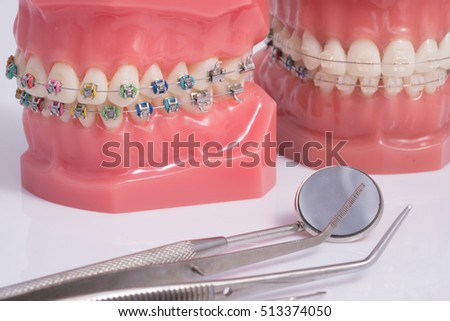 Dentist demonstration teeth model of varities of orthodontic bracket or brace with flesh pink gums and dentist tool