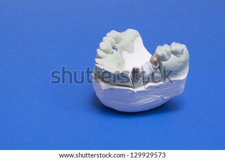 Dental Lab Work. blue background