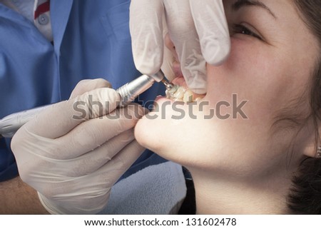 An extreme close-up of a dental patient having their teeth cleaned and polished by the hygieniest.