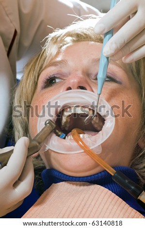 At the dentist - teeth whitening