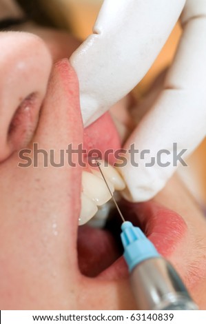 At the dentist - dental injection