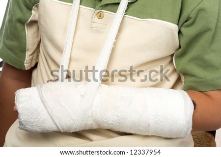 close up shot of a boy with broken arm