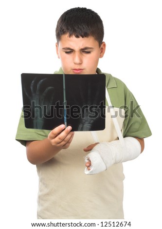 broken arm bone. with roken arm looking at