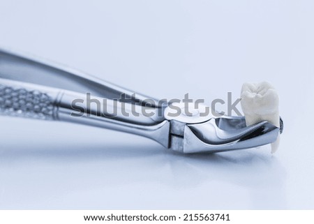 Pliers for wisdom tooth removal by a dentist