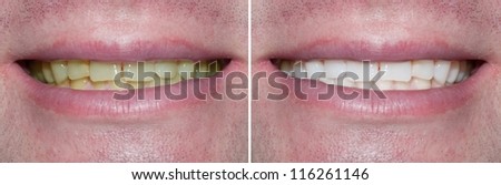 Whitening. Dental care. healthy man white teeth.
