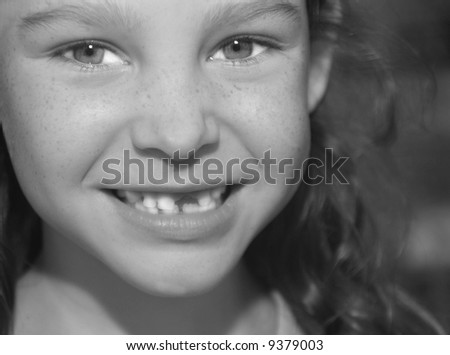 Young girl missing front tooth