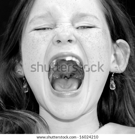 Young girl with missing front teeth yelling loudly