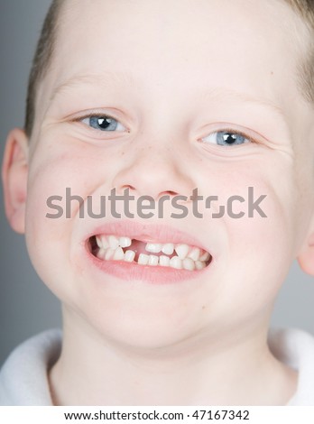 Happy boy proud of missing front tooth