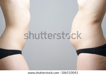 Obesity before after. Young woman\'s body on gray background.