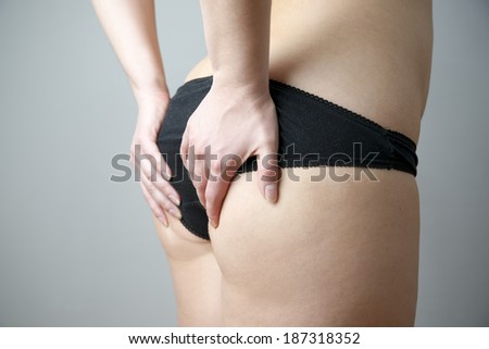 Buttocks massage against cellulite. Fatty female hips. Skin care, cellulite. Obesity