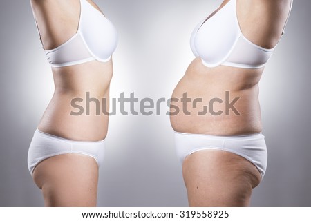 Woman\'s body before and after weight loss on a gray background