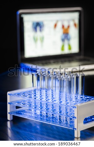 set of test tubes in a laboratory with a computer in the background