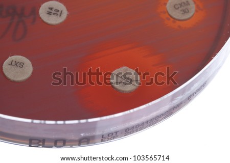 Petri dish close up. Bacteria culture.
