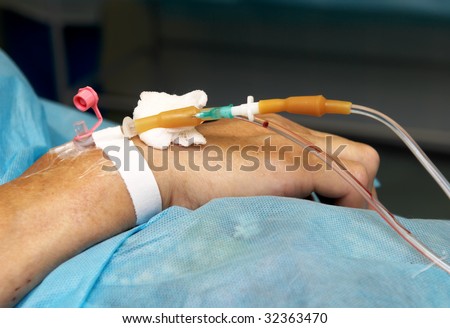 Catheter, inserted in body of patient