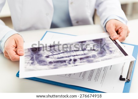 Woman dentist looking at teeth x-ray in dental clinic office. Doctor analyzing scanned jaw of his patient. Shallow depth of field.
