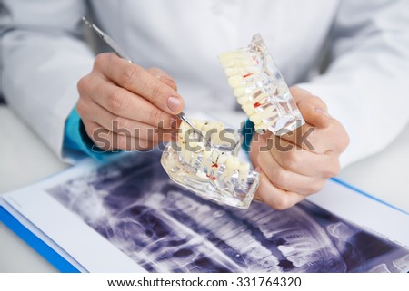 Teeth inspection. Health care. Woman doctor analyzing tooth caries on teeth model and x-ray.