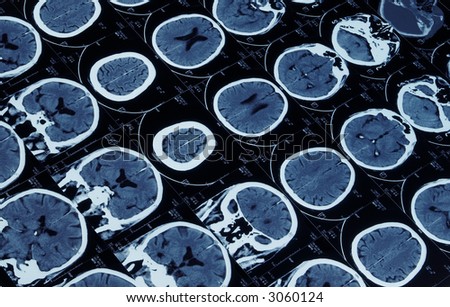 mutiple magnetic resonance image of brain and cranium