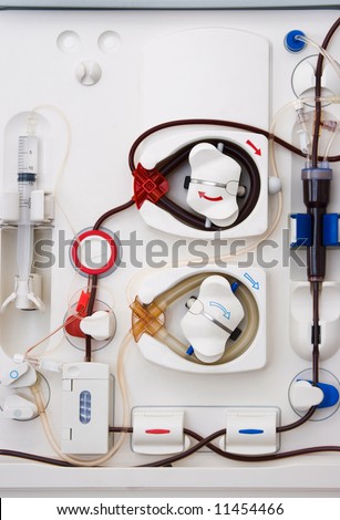 arlificial kidney (dialysis) medical device with rotating pumps